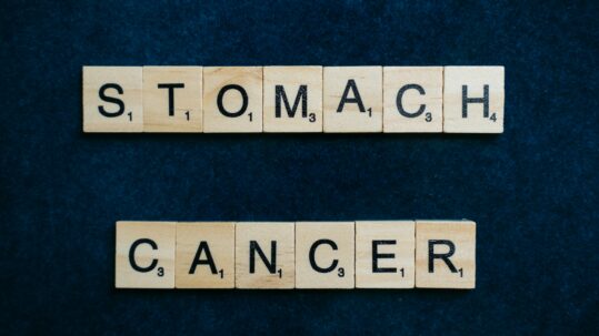 stomach cancer